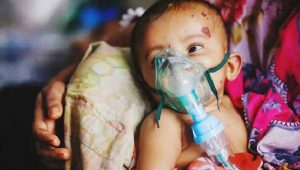 হাম উপসর্গে আরও ১১ শিশুর মৃত্যু