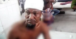 অটোরিকশা স্ট্যান্ডে চাঁদাবাজি নিয়ে শ্রমিকদলের দু’পক্ষের সংঘর্ষ