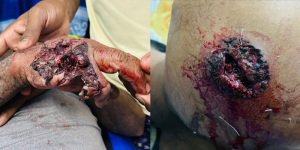 সাতক্ষীরা সীমান্তে বিএসএফের গুলিতে দুই বাংলাদেশি আহত