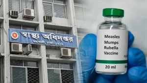 হাম উপসর্গে আরও ৭ শিশুর মৃত্যু