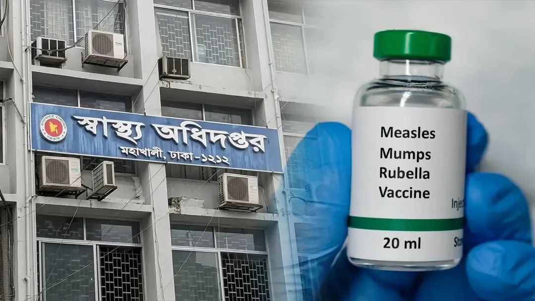 হাম উপসর্গে আরও ৭ শিশুর মৃত্যু