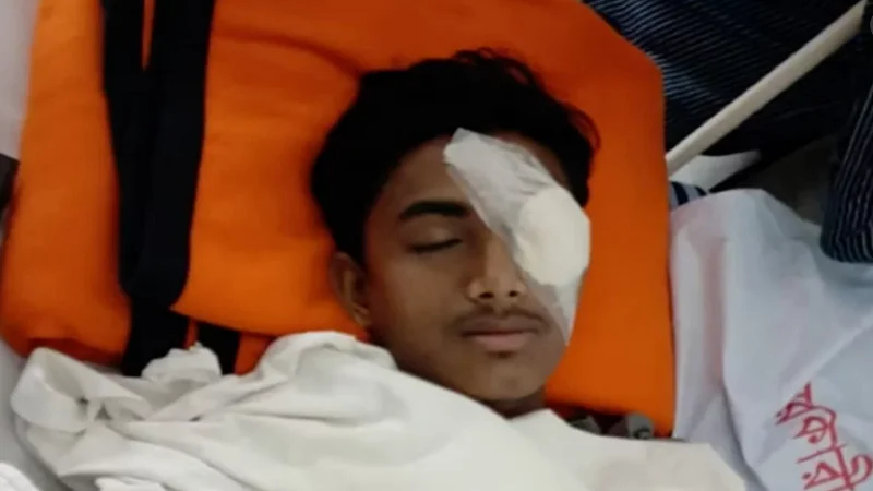 বাবা অসুস্থ, মা প্রতিবন্ধী: হবিগঞ্জে হামলায় চোখ হারালেন আলিফ
