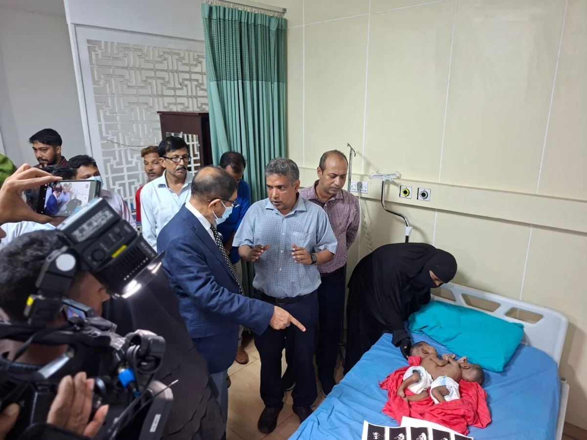 পেট জোড়া লাগানো ২ শিশুকে দেখতে গেলেন স্বাস্থ্যমন্ত্রী, চিকিৎসা শুরু সরকারি খরচে