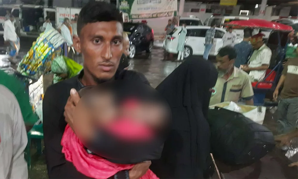 জোড়া লাগা সেই দুই শিশু চিকিৎসাধীন অবস্থায় মৃত্যু